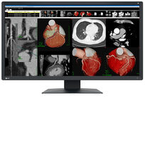 Eizo MX317W